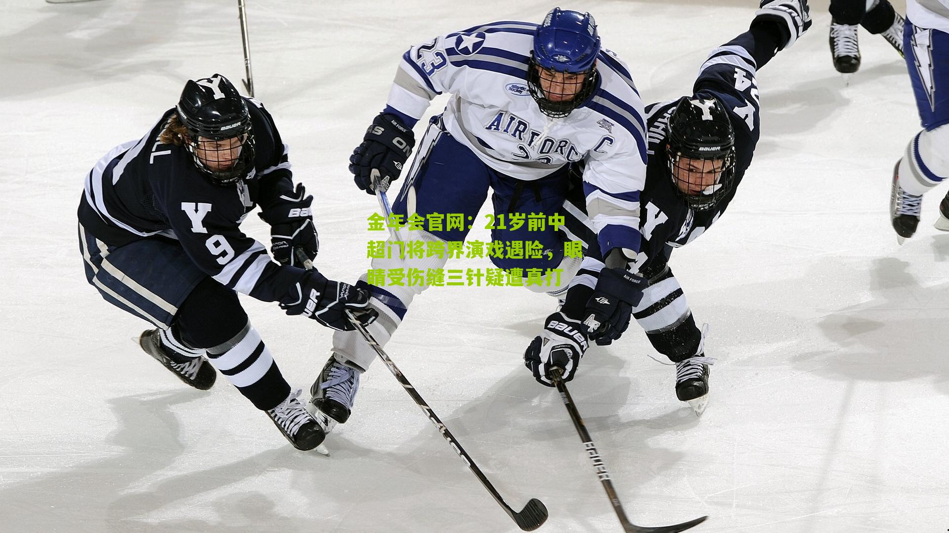 21岁前中超门将跨界演戏遇险，眼睛受伤缝三针疑遭真打